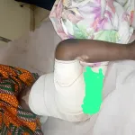 grand-lahou-un-enfant-de-3-ans-grievement-brule-apres-une-chute-dans-la-sauce-de-la-voisine