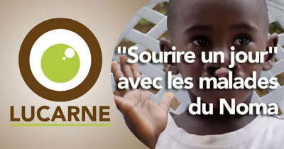 lucarne-quot-sourire-un-jour-quot-avec-les-malades-du-noma