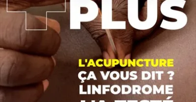l-acupuncture-ca-vous-dit-linfodrome-l-a-teste-pour-vous