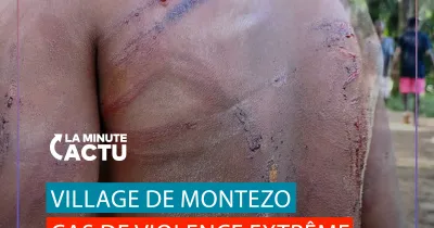 a-montezo-pres-d-alepe-un-jeune-garcon-a-subi-une-terrible-violence-de-la-part-de-son-oncle