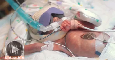 le-bebe-premature-qui-emeut-la-toile