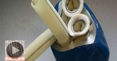 un-coeur-totalement-artificiel-made-in-france-implante-mercredi-une-1ere-mondiale