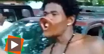 ce-jeune-homme-a-une-bouche-extraordinaire